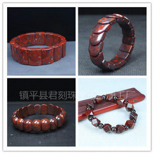 ��Ȼ�t����������Ź����uѪʯ�ִ���Ů���uѪ���Eʯֱ��؛Դ���l