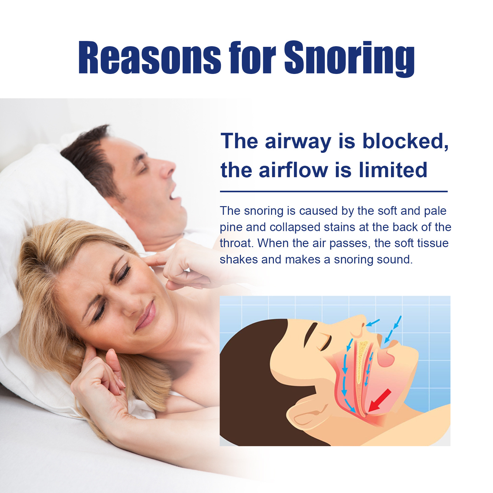 Nosni dilatator proti smrčanju South Moon, dilatator nosnic proti smrčanju in smrčanju, fiksna ventilacija, korektor proti smrčanju_voghion.com