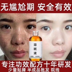 【エステサロン】メラニンを除去する強力なそばかす除去液、恥ずかしい期間なし、非侵襲性のそばかす除去液、卸売在庫あり