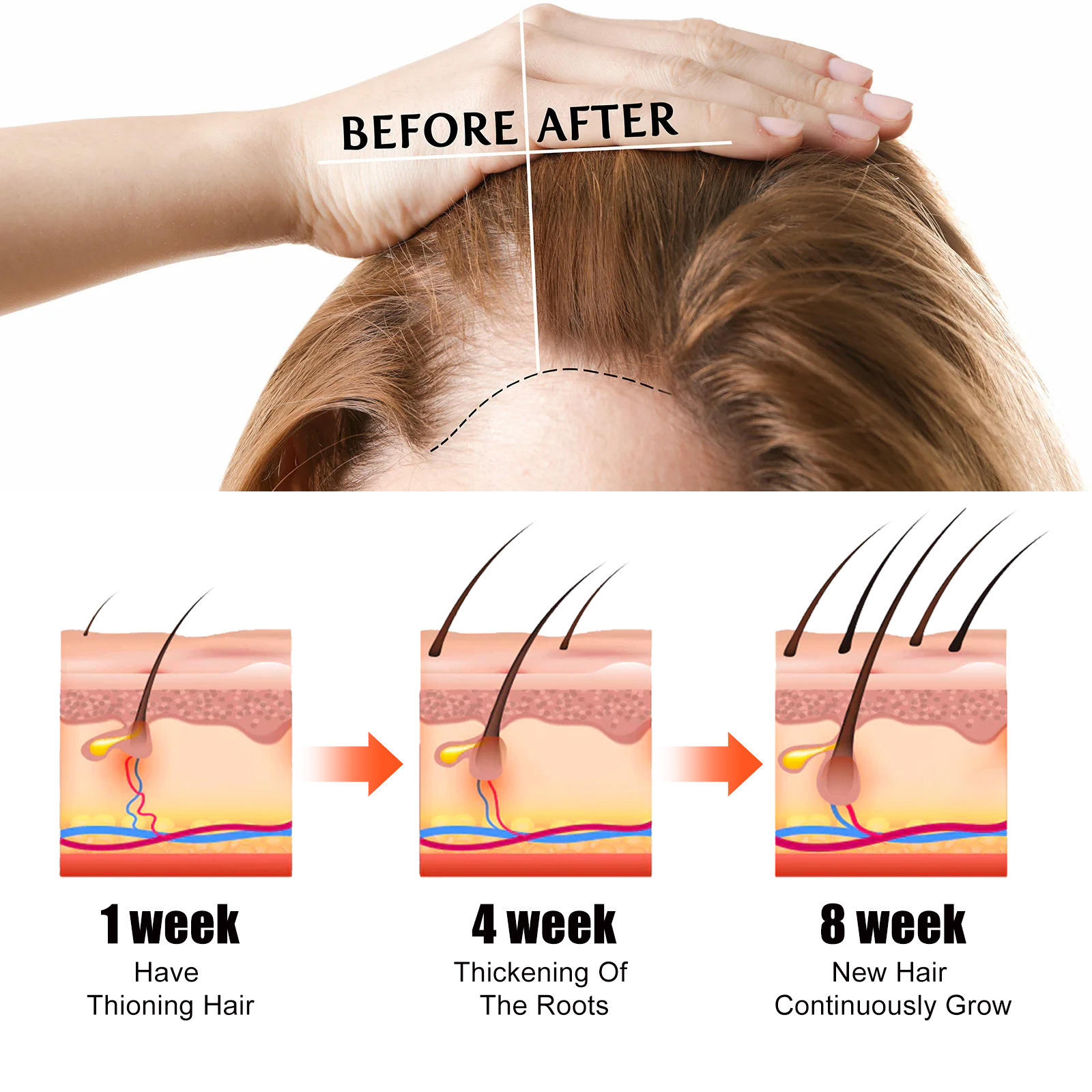 Liquido denso EELHOE Idrata, previene la caduta dei capelli, solidifica, rinforza e rinforza i capelli. Castore Hai._voghion.com