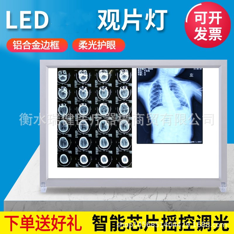 薄款X光观片灯箱led牙科看片灯箱阅片灯单联骨科用看观片灯双联