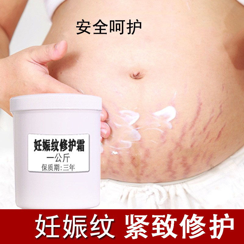 Wholesale of Stretch Mark Reduction Cream for Pregnant Women, Postpartum Stretch Marks, and Postpartum Stretch Mark Repair Cream