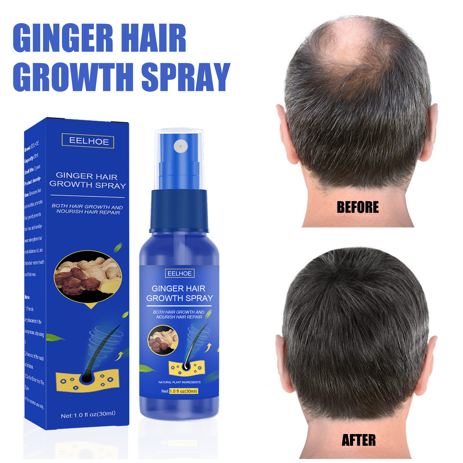 Ginger Scalp EELHOE Masāžas Mitrinošs Biezu Matu Kopšanas Uztura Sprejs_voghion.com