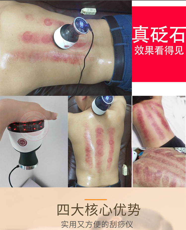 砭石负压刮痧仪详情_03.jpg