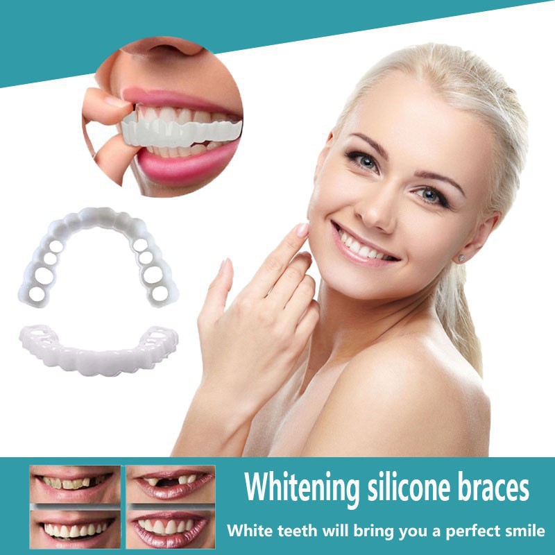 Snap-On Smile Image 1