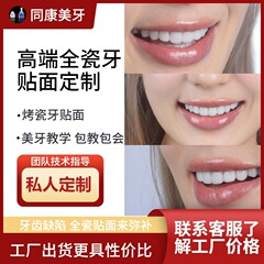 磁器の歯を焼いて歯を貼ります。美白ガラスの歯を貼ります。