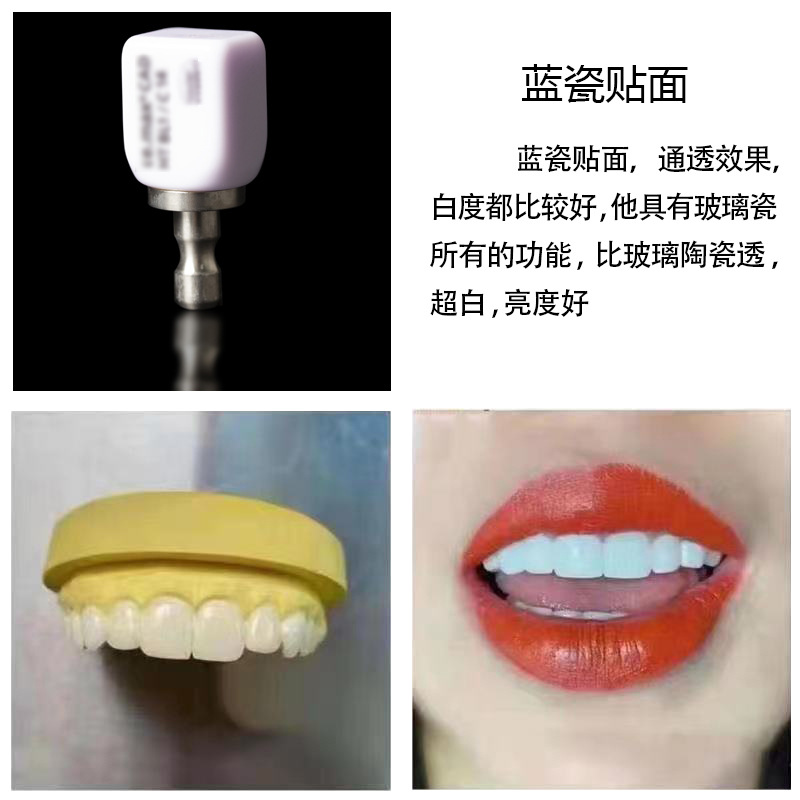 Tiras blanqueadoras de dientes, dientes de porcelana privados, porcelana azul, porcelana ámbar, enseñanza y formación para estudiantes, carillas totalmente cerámicas