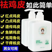 烟酰胺维C润肤乳保湿补水亮白牛奶身体乳去鸡皮一洗变白提亮