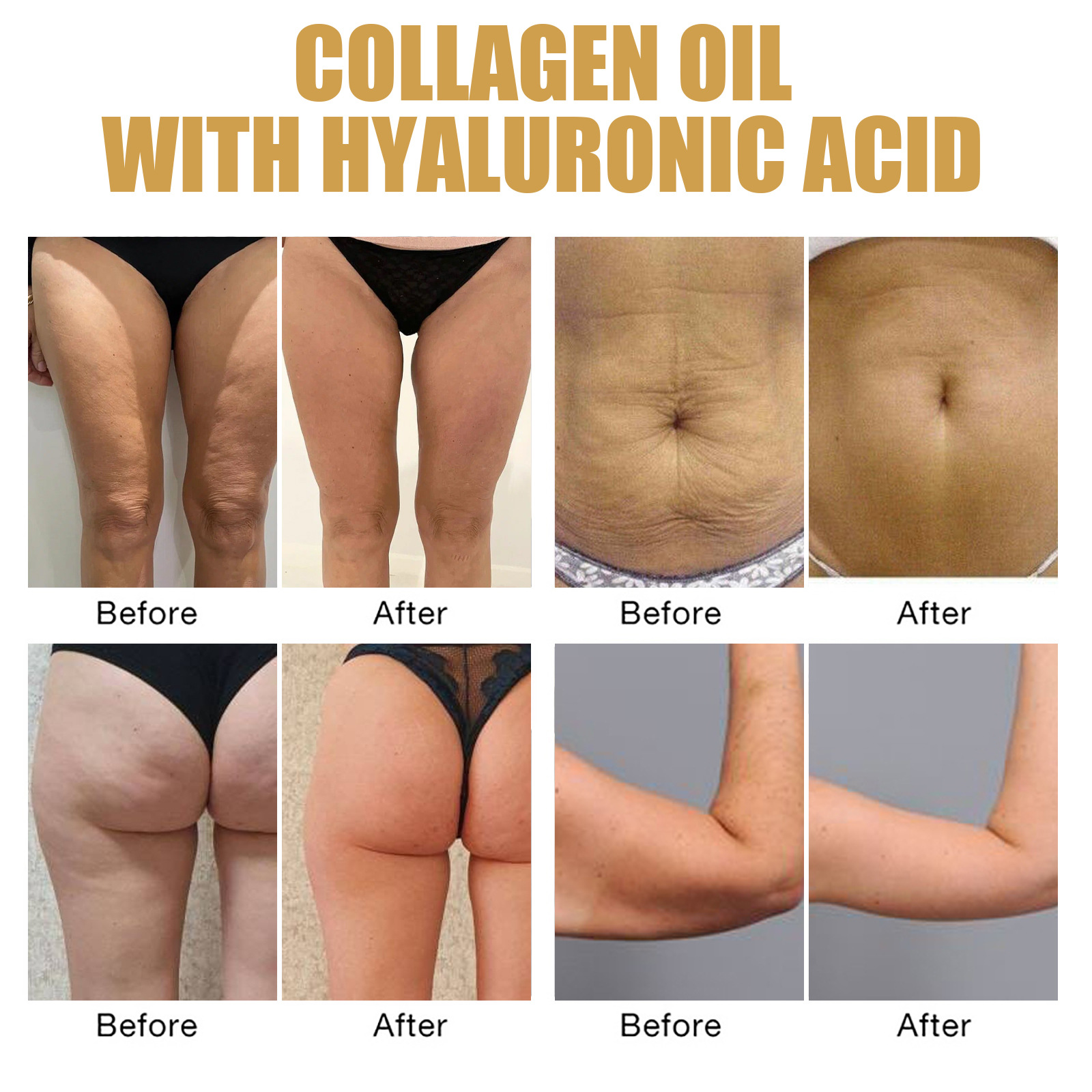 Firming Collagen Oil Shaping And Belly Trimming