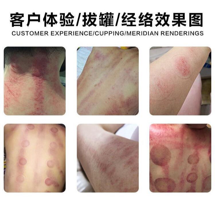 Mai Jiaxin Xin ライフ エネルギー機器 ボディ機器 Xin グラッキング理学療法 マッサージ美容機器 本店と同じスタイル|undefined