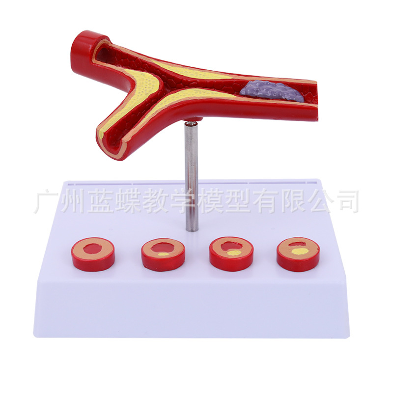 ���������״��������Ѫ�ܶ���ģ��Ӳ��ģ����������ģ��Ѫ˨ģ��