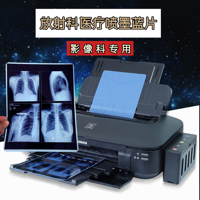 Inkjet blue medical film Blue Base dry radiology printing film dental fracture X-ray film DR CR CT