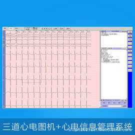 三锐心电图机医用工作站信息管理系统自动分析结果检测仪HIS连接