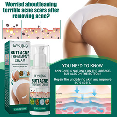 Jaysuing Butt Acne Cream: Gentle Facial Treatment, Nourishing Formula to Fade Blemishes, Leaving Skin Refreshed, Soft, and Hydrated