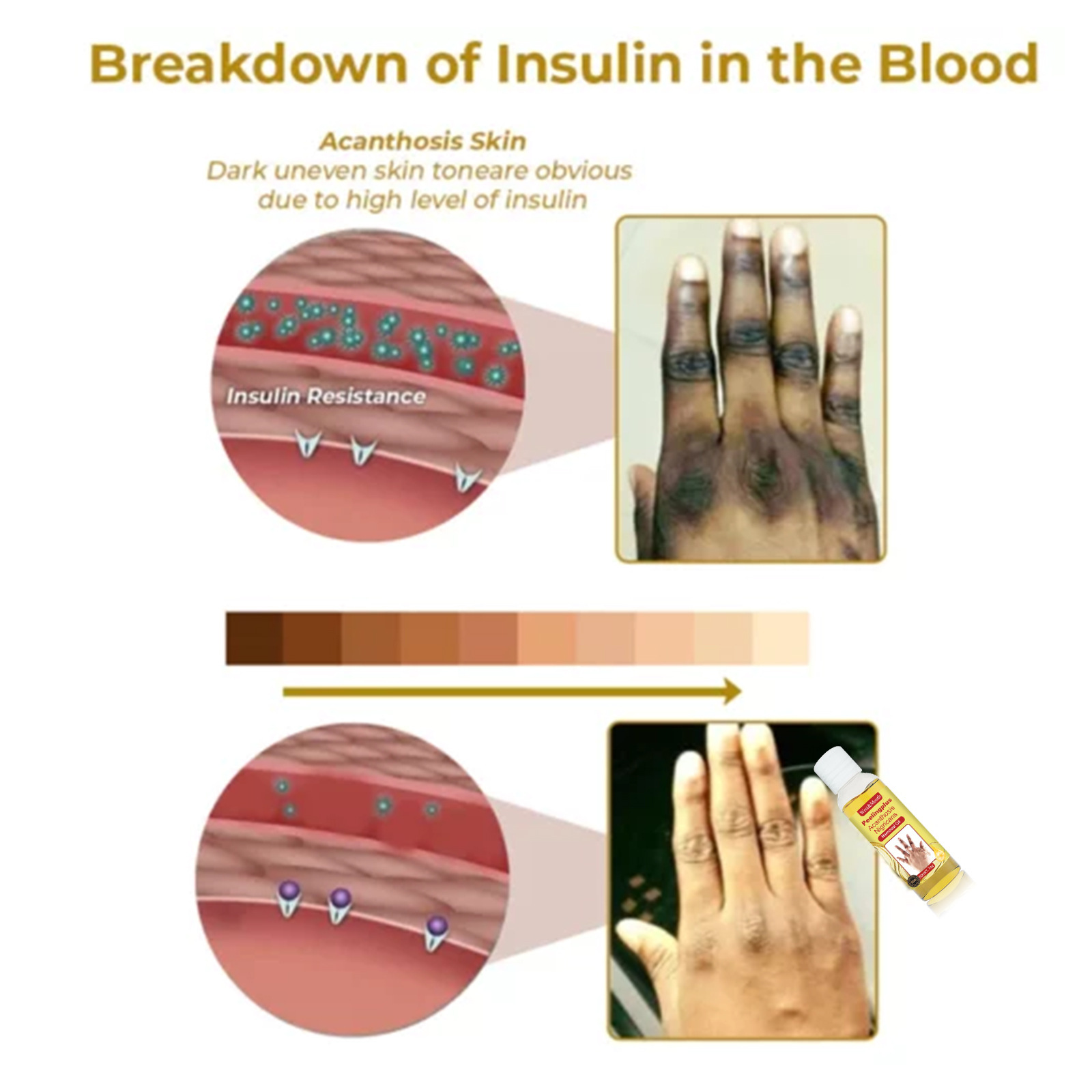 Huile éclaircissante pour traitement de l'acanthosis nigricans_voghion.com