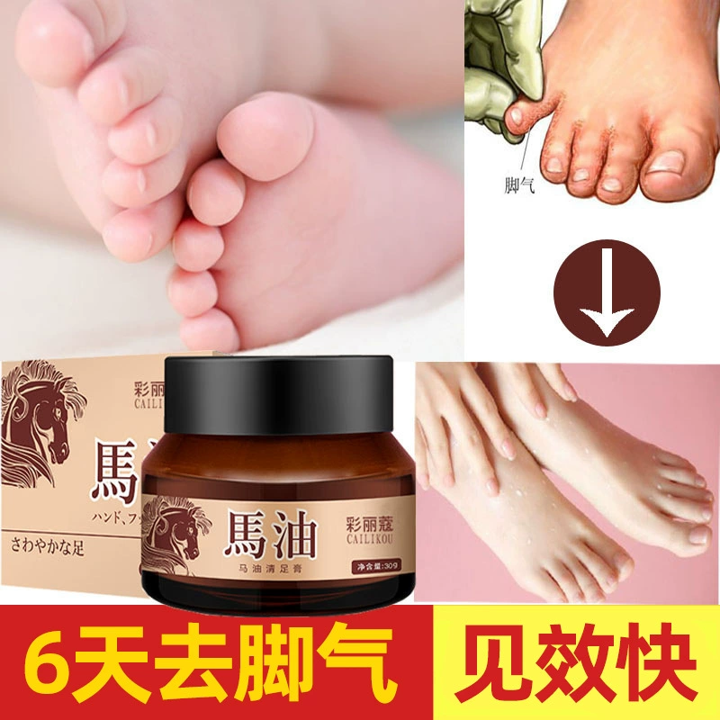 Японский крем для ног с лошадиным маслом быстро вступает в силу, удаляя запах ног, зуд ног, пот ног, крем для очистки ног, крем против трещин, против замерзания