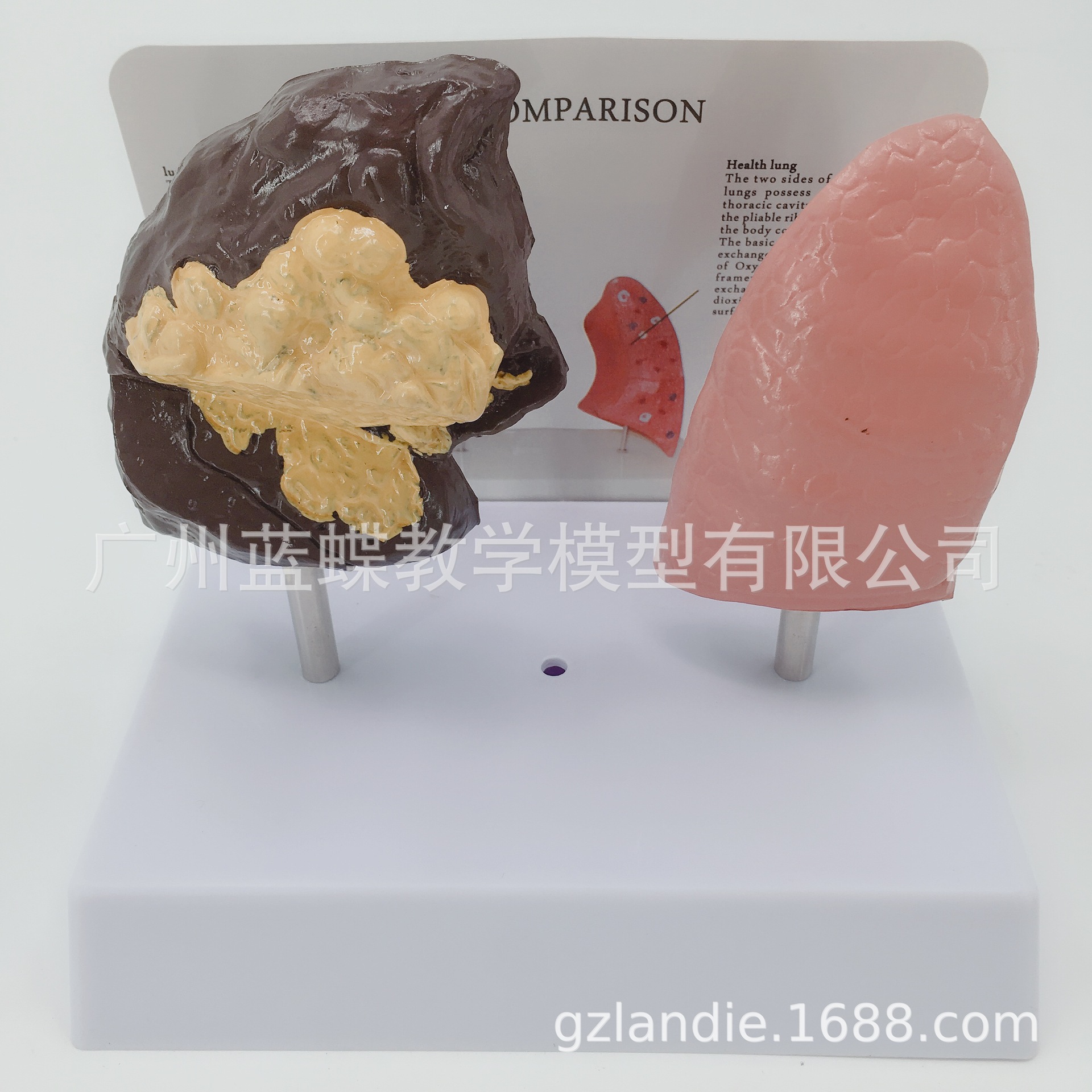 �������ཡ�����벡̬�αȽ�ģ�� �����ν���ģ�� �����ζԱ�ģ��