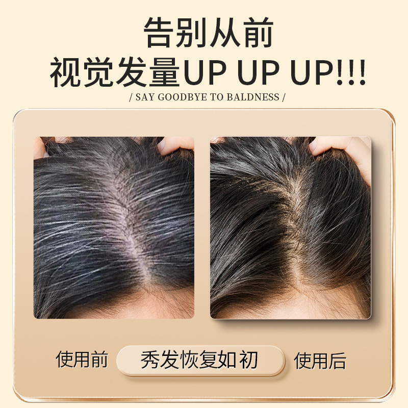 特一防脱养发精华液草本植物养发护发滋养毛囊特征防脱发精华液|undefined