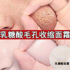 乳糖酸クリームは黒頭にきびに行きます。口を閉じて毛穴を縮めます。