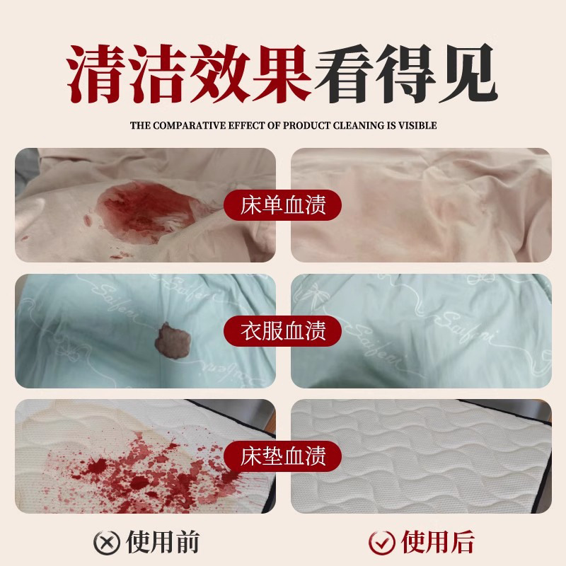 去血渍专用清洗剂陈旧血迹床单垫蛋白酶血渍净月经大姨妈清洁神器|undefined