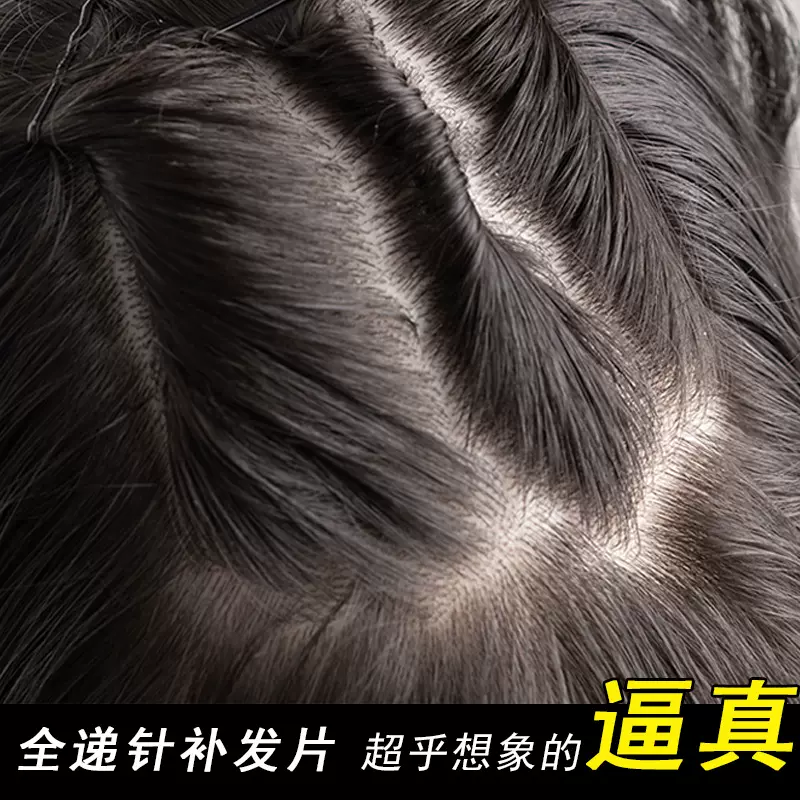 双递针假发片真发全真人发头顶补发片女遮白发蓬松增发量无痕假发