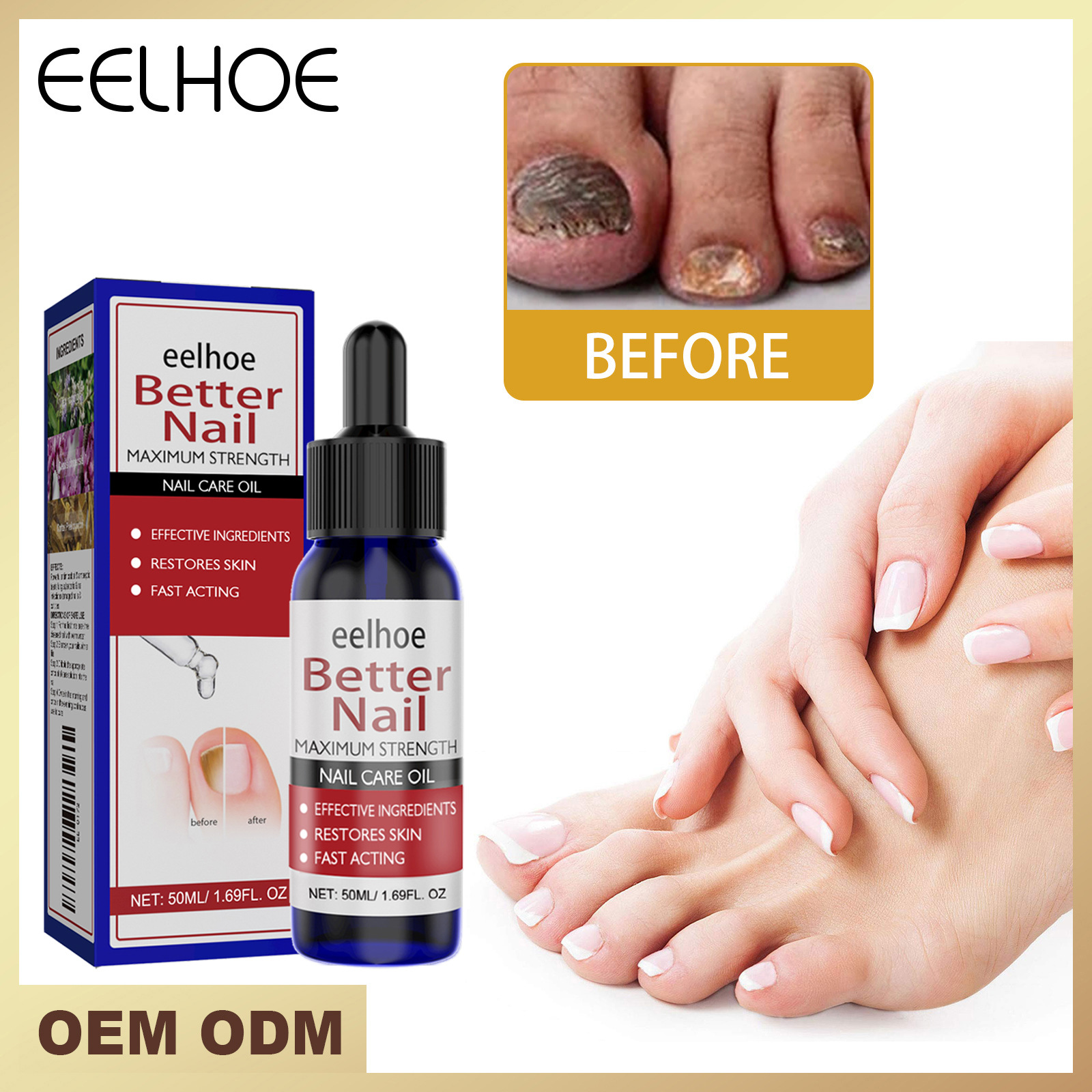 Eelhoe Nail Care Solution Nail Care Hand and Foot Nail Care Moisturizing Cleansing Nail Care Solution