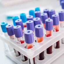 Ѫƿ���t�����z WACKER�߿�ELASTOSIL&reg; RT 601 �Ҝ����p�M�ֹ�