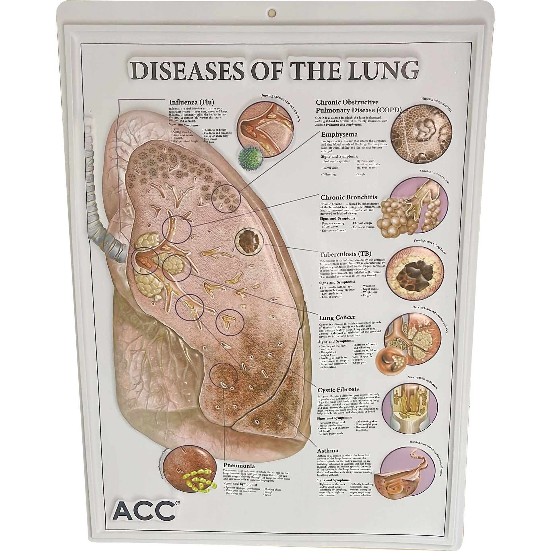 厂家制作立体吸塑画 广告凹凸画  彩色吸塑海报