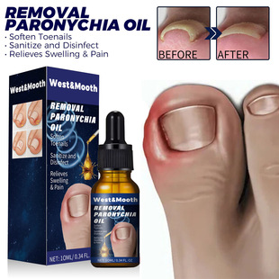 �羳ָ���o���ͻ�ָ������Ƕ��ܛ���̝��o��ָ���ճ��o���ʹ��l