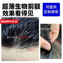 全递针真发假发男士生物头皮无痕头顶补发片真人秃顶