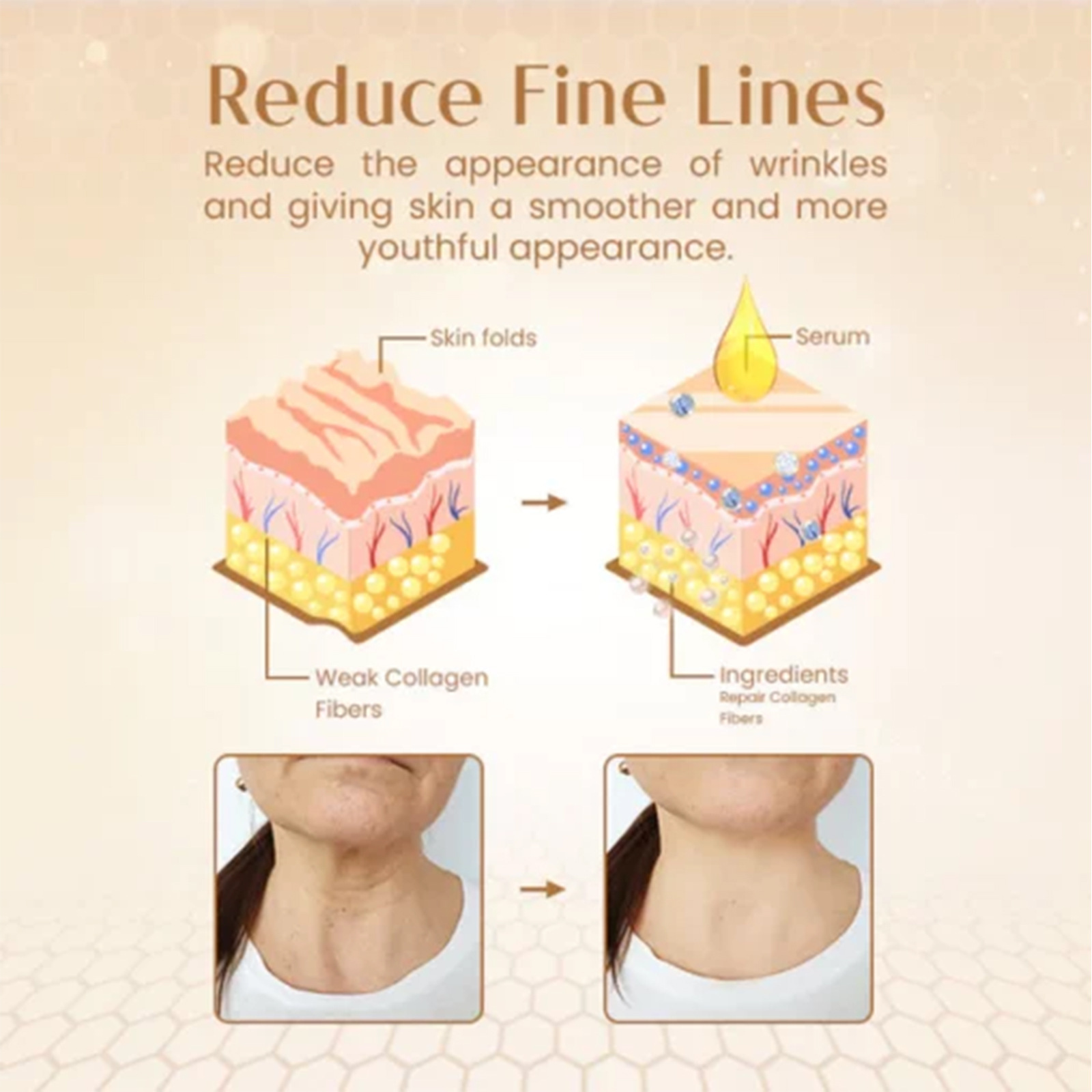 EELHOE Bee Venom to weaken facial fine lines, tighten moisturize skin, and prevent aging essence_voghion.com