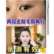 �۲�����ȥĘ���uƤ�w����ë�ܽǻ����t�����l�ڴֲ�Ę��ȥ�uƤ�w