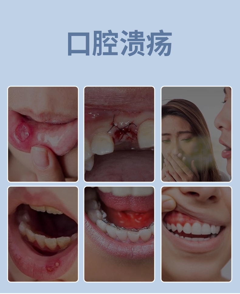 Medical Oral Ulcer Care Spray 25ml Mouth Inflammation Relief Adult Oral Care quality and texture