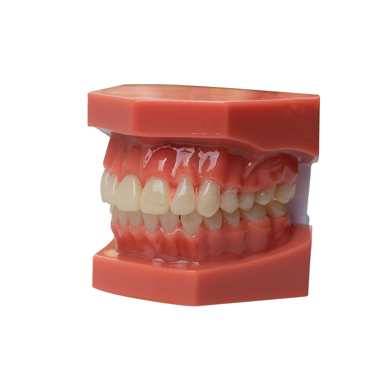 Modelo dental, modelo de corrección de demostración de mandíbula incorrecta, práctica de dentista, modelo de brackets pegajosos, molde de enseñanza de corrección