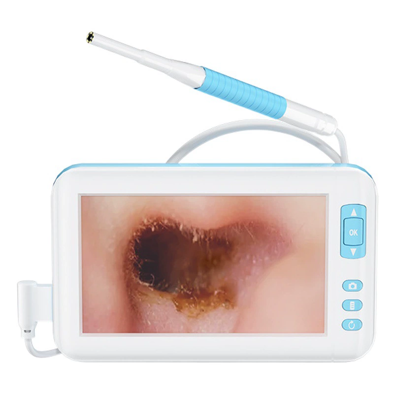 Визуальный инструмент для чистки ушей, интегрированный отоскоп для техников, ушная лопатка, высокое разрешение
