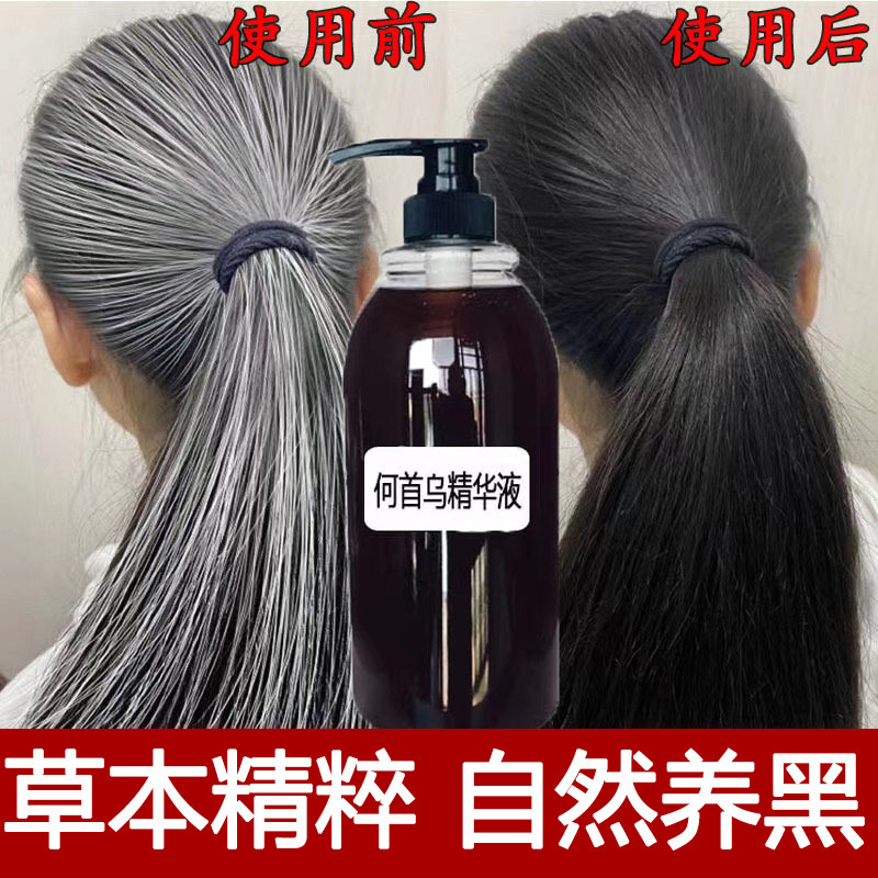 White Hair Nourishing Black Hair Essence, White to Black Essence, Black Hair Development Essence, Scalp Hair Follicle Nutrient Solution, Black Hair Nourishing Solution White Hair Nourishing Black Hair Essence, White to Black Essence, Black Hair Development Essence, Scalp Hair Follicle Nutrient Solution, Black Hair Nourishing Solution