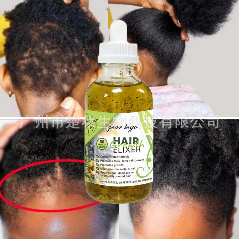 Cross-border herbal hair oil hair growth liquid, hair growth and dense hair, rosemary repair and dense hair essential oil, hair care essential oil