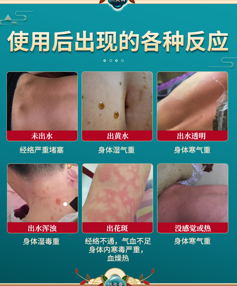 Crystalline Herbal Heat Therapy Paste 700g Warming Topical Massage Paste for Neck Shoulder Back and Legs in use