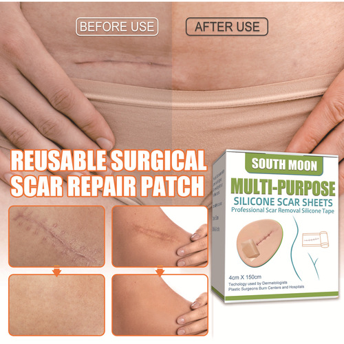 South Moon Silicone Gel Scar Patch, Lightening, Repairing, Pregnancy and Smoothing Skin Surgery Scar Patch