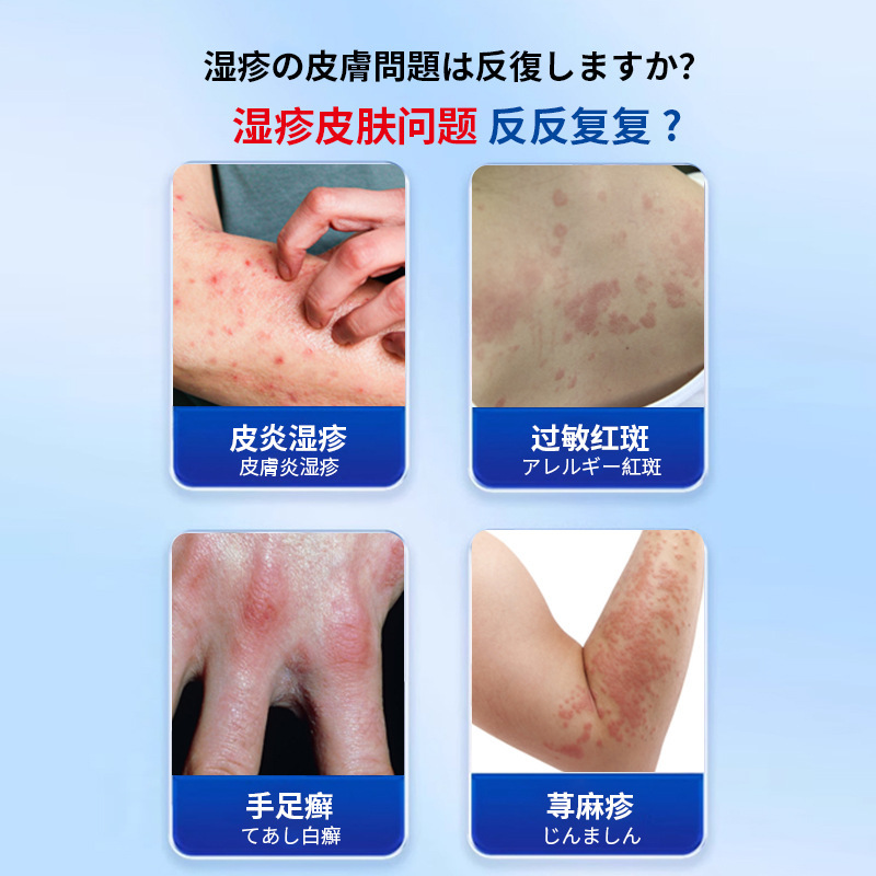 アレルギー、発赤、かゆみ、不快感、皮膚の赤み、腫れ、皮膚炎の修復用外用皮膚かゆみ止めクリーム、工場直送|undefined