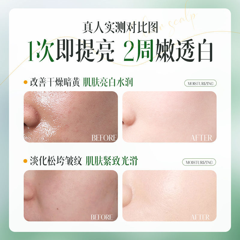 Ruyi 美白とシミマスク 女性と男性向けの保湿と黄ばみとくすみの除去、修復と抗酸化作用 正規品公式|undefined