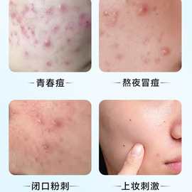 医用水胶体痘痘贴痘痕创口贴人工皮可上妆遮盖遮掩伤口隐形贴无菌