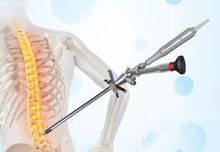 全脊柱微創 椎間孔鏡手術用的器械 骨科耗材消融電極 優惠價格低