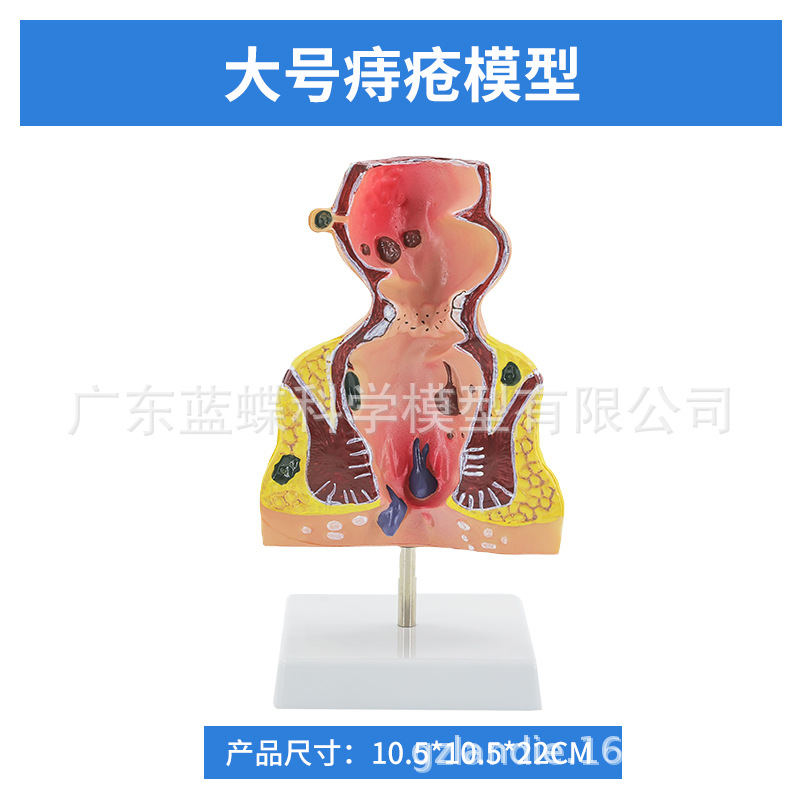 ��ѧ��������󳦲���ģ�ͳ�θֱ���̴�������ʳ��������᳦����