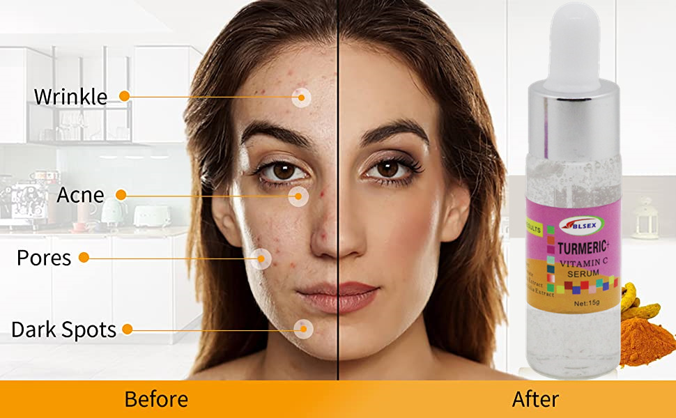 Siero alla vitamina c con olio di curcuma idratante viso_voghion.com