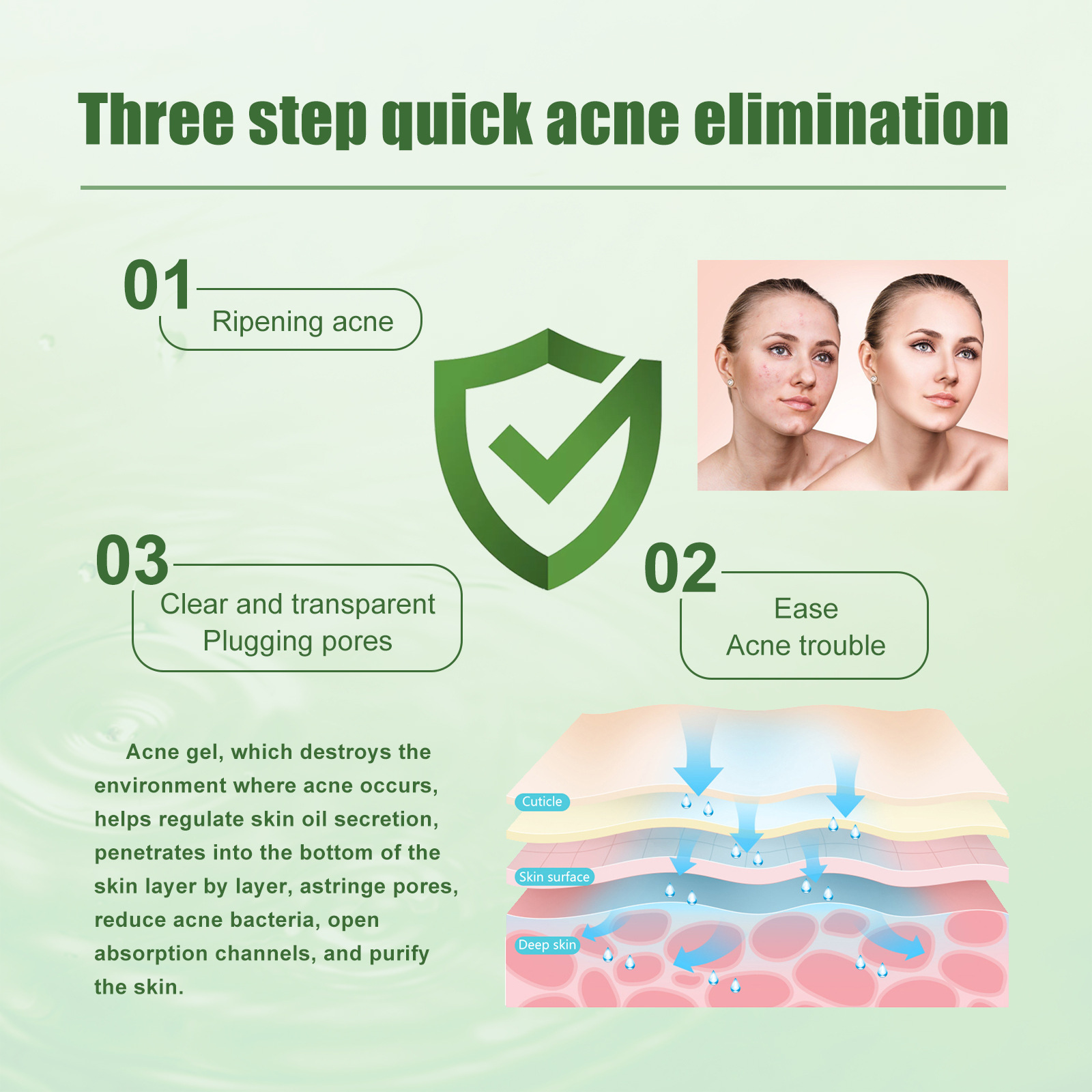 South Moon Acne Removing Gel to lighten acne scars, remove pimples, close mouth, clean brighten the skin, and_voghion.com
