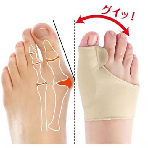 Silicone Toe Spacers, Big Toe Overpronation Corrector, Toe Separator Corrector for Hallux Valgus, Toe Corrector Sleeve
