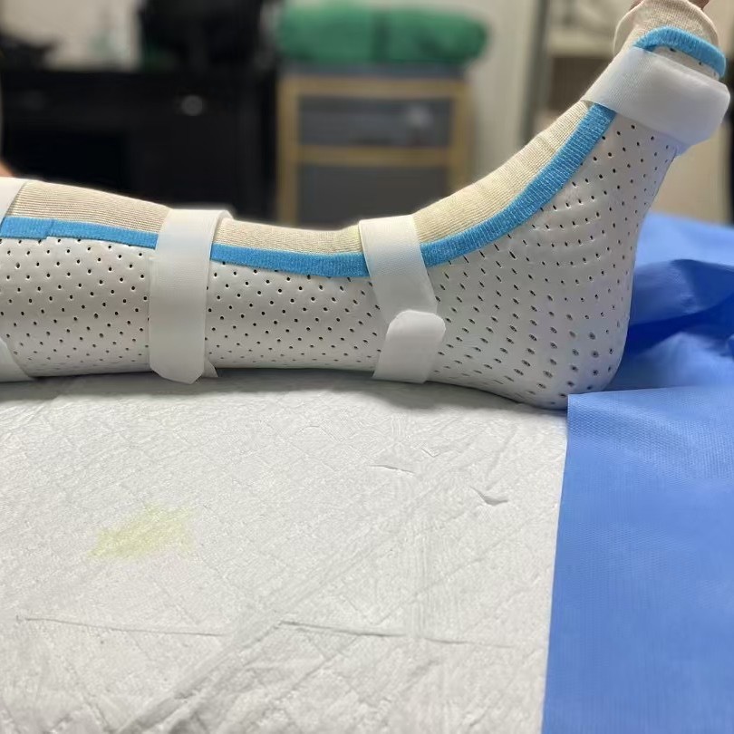 整形外科用固定装具、足の捻挫用熱可塑性装具、石膏の代替品、手足関節用低温熱可塑性プレート