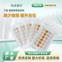 �羳��ͨ����С�i ˮ�z�w�p��͸�ⶻ���N �۴̃����N��ӡ���w�N�F