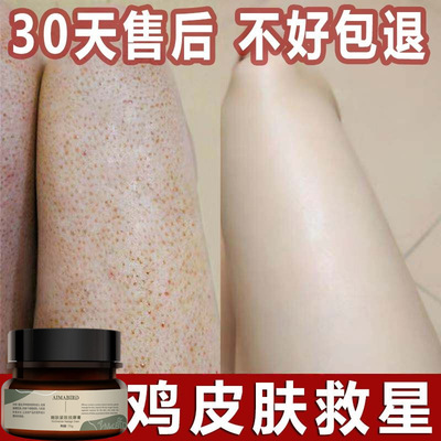 跨境去除角质暗沉磨砂膏去鸡皮肤粗糙皮肤疙瘩死皮全身膏鸡皮霜|ms
